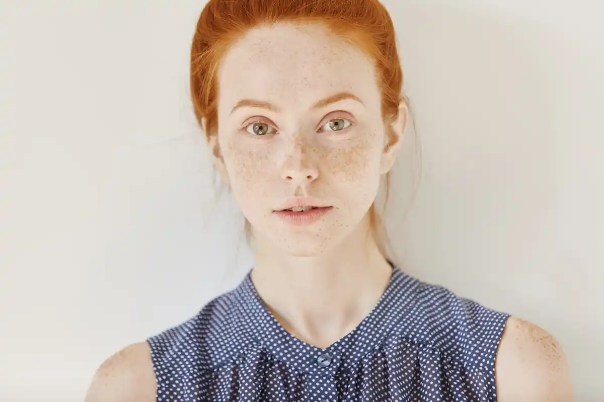 dutch freckles diversity dna closeup young woman