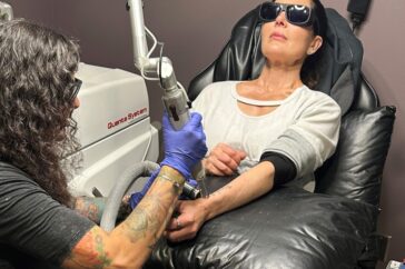 De onzichtbare kost: het proces en de implicaties van het verwijderen van tatoeages