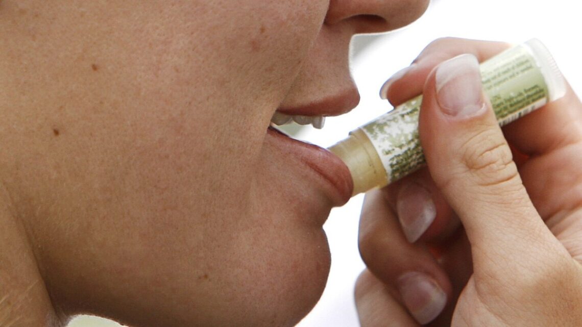 Helpt lippenbalsem tegen gebarsten lippen? Wat u moet weten